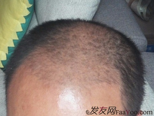 第777页